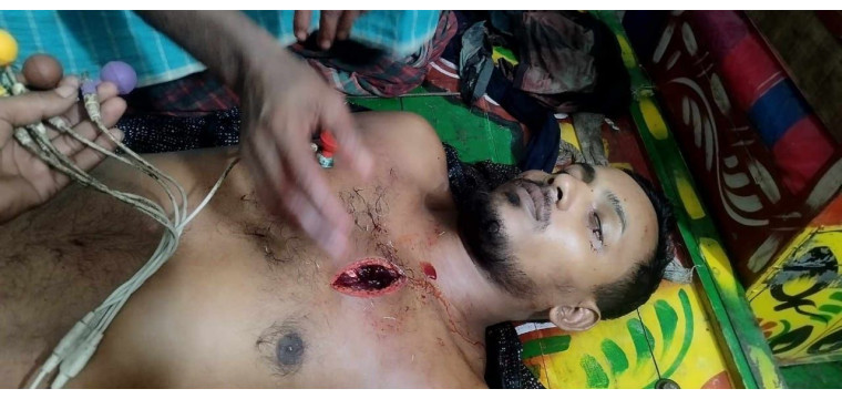 রাজশাহীর মোহনপুরে সংঘর্ষে বিএনপি কর্মী নিহত 