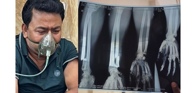 নাটোরে সাংবাদিকের ওপর বিএনপি কর্মীদের হামলা