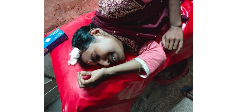 যৌতুকের টাকা না পেয়ে স্ত্রীকে পিটিয়ে জখম 