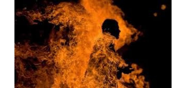 গ্যাস লিকেজ থেকে লাগা আগুনে দগ্ধ স্বামী-স্ত্রী